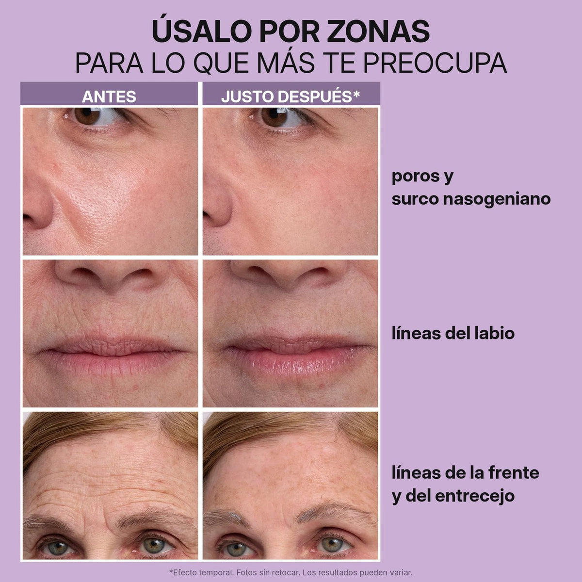 Frente, ojos, surco y cuello